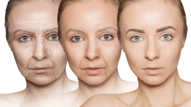 Ce Sunt Perfuziile Anti Aging și Cui I Se Potrivesc